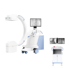 Mobile Digital FPD C-Arm-System Raidographie Röntgenlumbal Wirbel Fluoroskopie PLX118F